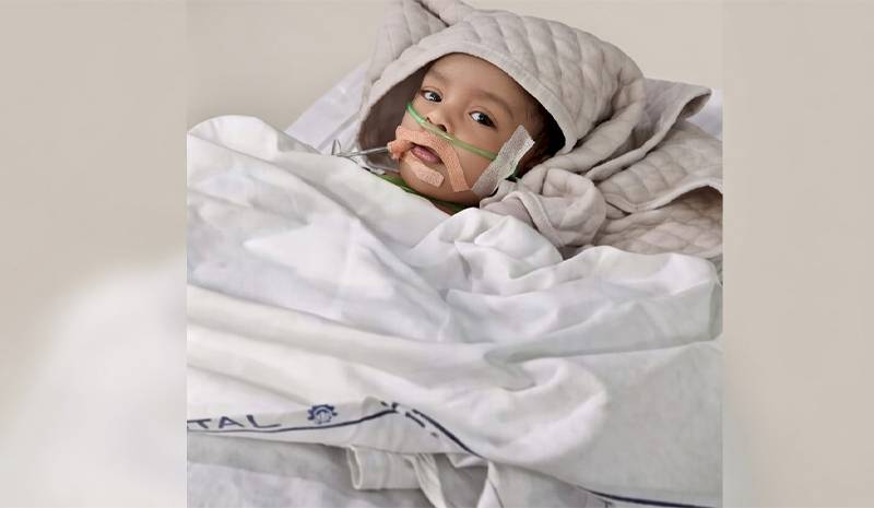 A One Year Old Baby Fighting for life