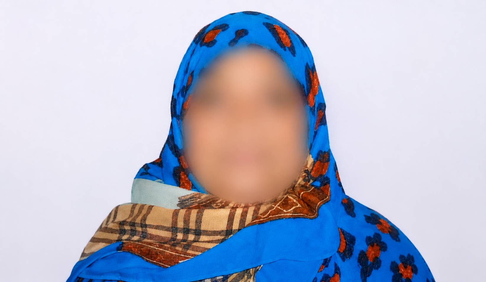 Save Mrs. Seher Bano From Advanced Gangrene